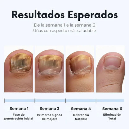FUNGAL NAIL PATCHES - PARCHES ANTIHONGOS DE RENOVACIÓN PROFUNDA